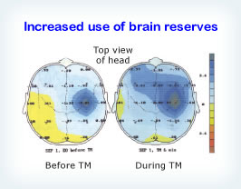 Brain Reserves